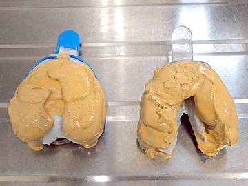 製造工程　マウスピース　歯形模型