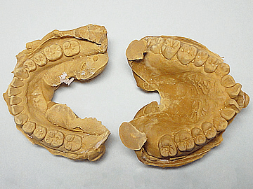 製造工程　マウスピース　歯形模型