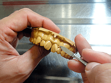 製造工程　マウスピース　歯形模型