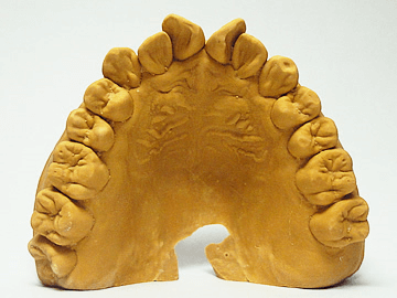 製造工程　マウスピース　歯形模型