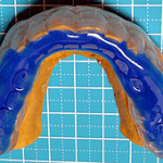 オプション　噛み合わせを付ける