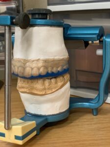 スポーツで「噛み締め」が重要な理由とは？